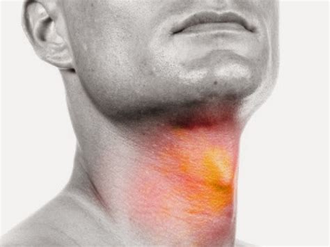 Recognize the Symptoms of Throat Cancer | Diseases and Viruses