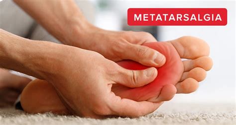 Metatarsalgia: What Is It and What Does Metatarsalgia Mean? – EASYFEET ...