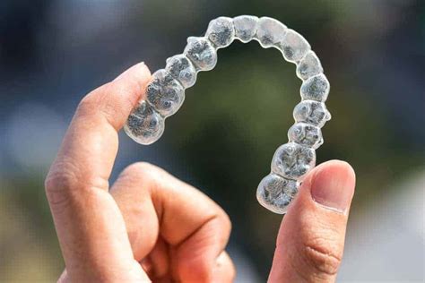 6 Alternatives to Braces for a Great Smile