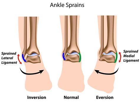 Foot and Ankle Injuries and Disorders