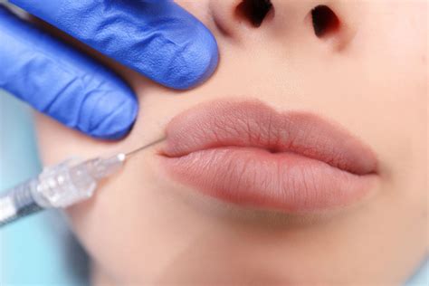 All You Need To Know About Lip Injections - Guest Post Today