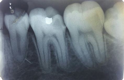 Dental X-rays - Shangrila Dental Clinic