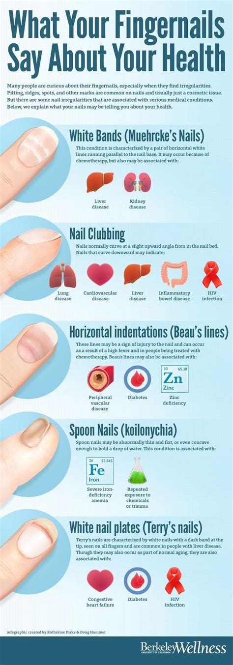 Canberra Ingrown Toenail Clinic | What Your Nails Say About Your Health