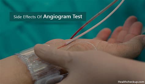 Risks and Side Effects of Angiogram Test by Dr Chathuri