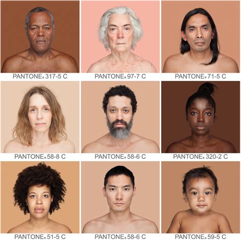 Racial Limitations of Fitzpatrick Skin Type | MDedge Dermatology | Skin color chart, Human skin ...