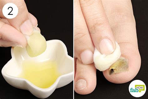 How to Get Rid of Toenail Fungus | Fab How