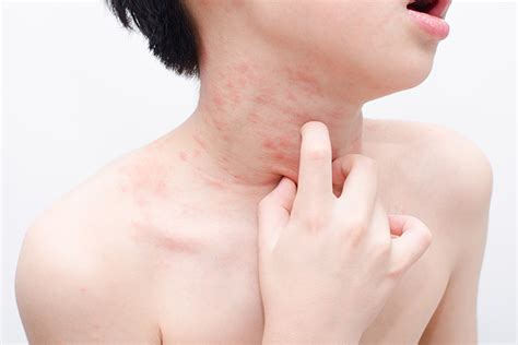 Skin Rashes In Children: Causes, Treatment And Prevention