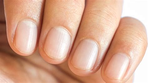 Nail Pitting: What Causes It & How You Can Treat It