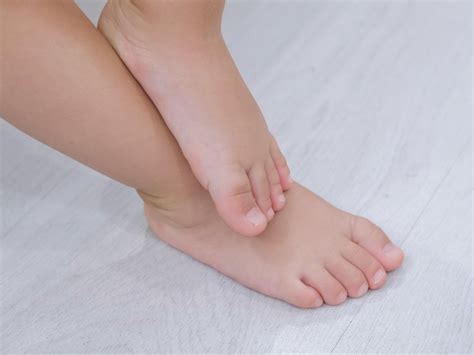 Flat Feet in Adults and Children - Highgate Podiatry Biomechanics Orthotics