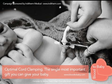 #BloodtoBaby - Optimal Cord Clamping | Fab NHS Stuff