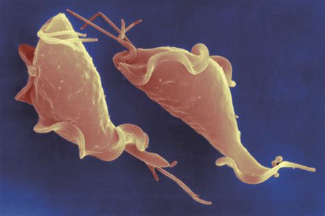 How To Detect Trichomoniasis In Men - Trackreply4