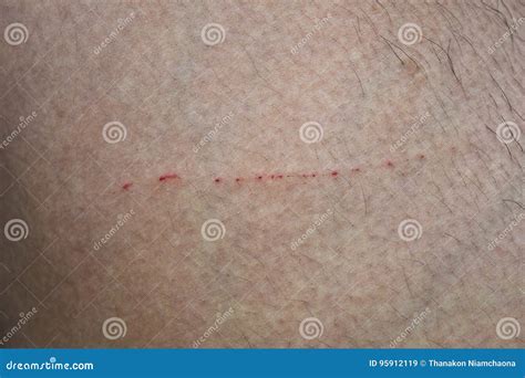 Wound from scratching cat stock image. Image of little - 95912119