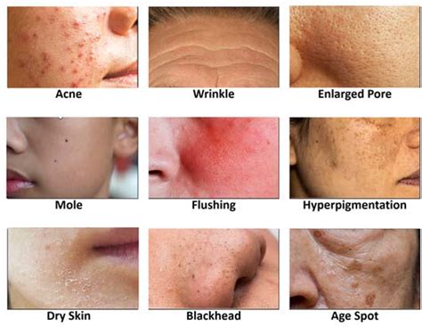 Applied Sciences | Free Full-Text | High Performing Facial Skin Problem Diagnosis with Enhanced ...