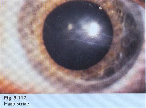 DOCZONE: INTERESTING OPHTHALMOLOGY CLINICAL PHOTOGRAPHS