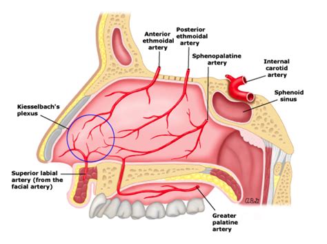 TXA In Epistaxis — NUEM Blog