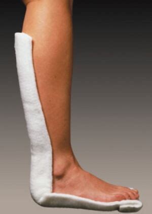 Posterior Short Leg Splint - WikiSM (Sports Medicine Wiki)