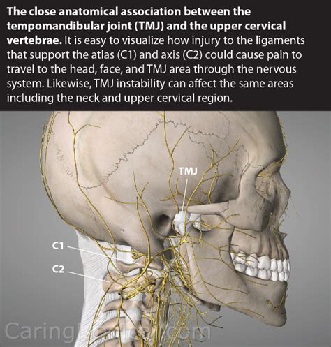 TMJ and Tinnitus: Should we explore the ligament chain from the cervical spine through the neck ...