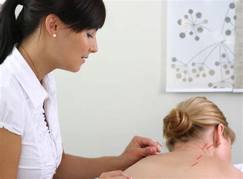 What Are the Benefits of Acupuncture for Vertigo?