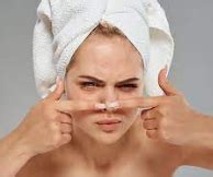 What causes acne on the nose? - benguinter.com
