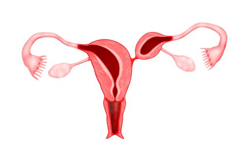 Chapter 11 – Congenital Uterine abnormalities – Melaka Fertility