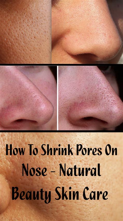 How To Shrink Pores On Nose – Natural Beauty Skin Care | Nose pores, Natural skin beauty ...