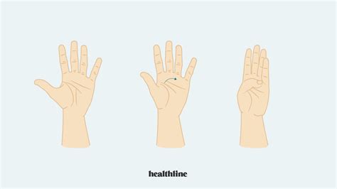 Stiff fingers: Causes, treatment, and stretches