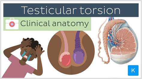 Testicular torsion: causes, symptoms, diagnosis and treatment ...