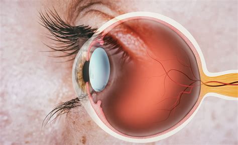 Corneal Abrasions - familydoctor.org