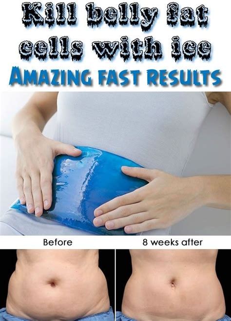 7 Images Freezing Fat Cells At Home With Ice Packs Reviews And Description - Alqu Blog