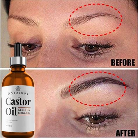 Cheap Nourish Castor Oil Hair Growth Skin Massage Essential Oil Eyebrows Growth Prevent Skin ...