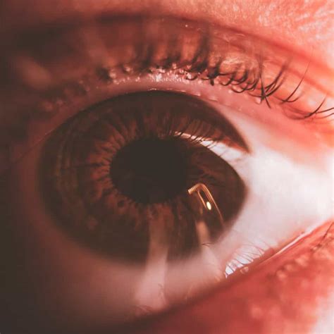 What Causes a Foreign Body Sensation In My Eye? - Dry Eye Directory