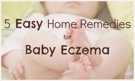 baby deals | Home remedies for eczema, Baby eczema, Baby remedies