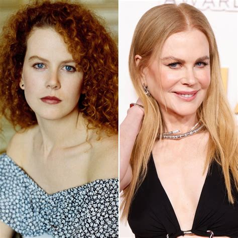 Nicole Kidman Addressed Plastic Surgery and Botox Rumors After Dramatic ...