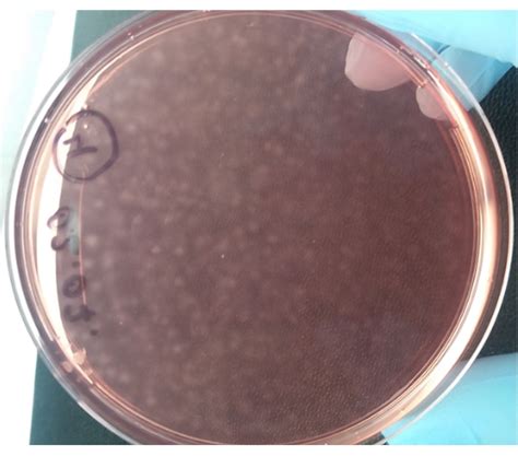 Cultivation Methods of Spirochetes from Borrelia burgdorferi Sensu Lato Complex and Relapsing ...