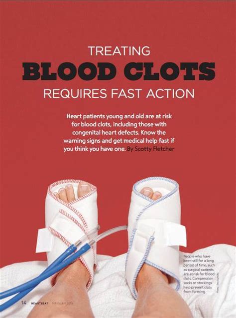 Treating Blood Clots Requires Fast Action - Mended Hearts