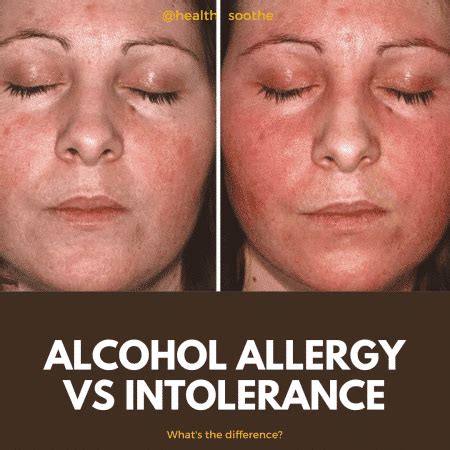 Alcohol Allergy Vs Intolerance: What's The Difference?