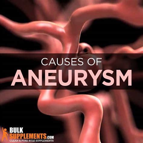 Aneurysm: Symptoms, Causes & Treatment