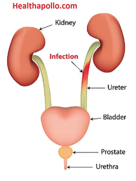 UTI ( Urinary Tract Infection) Causes, Symptoms and Home remedies