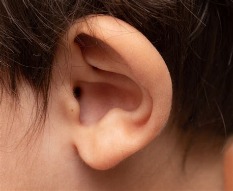 Eczema In Ears - Symptoms, Treatment