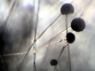 Microscopic pictures of tempeh molds.