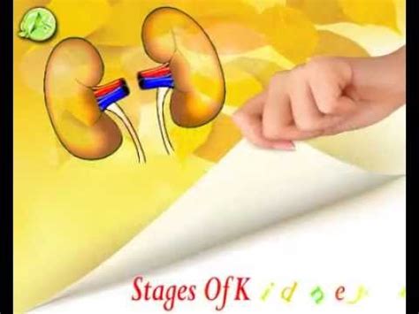 Stages of Kidney Disease | Stages of Renal Diseases | Advance Ayurveda - YouTube