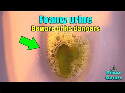 When urine is foamy