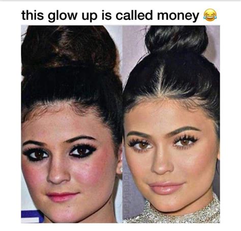 Kylie Jenner Lips Money Meme Glow Up Haha