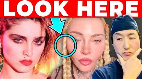 Plastic Surgeon Reacts to MADONNA’S Cosmetic Surgery Transformation ...