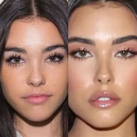 Madison Beer natural face vs after plastic surgery. Madison is a tiktok influencer known for ...