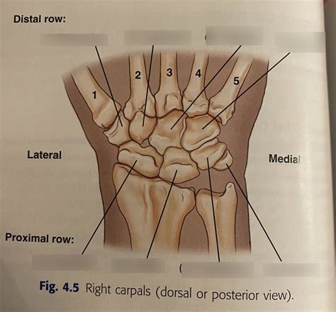 Carpal Bones (PA view) Diagram | Quizlet