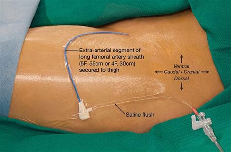 Groin Area Anatomy