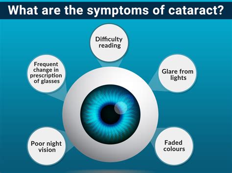 Symptoms of cataract [Infographic] - Jaheed Khan