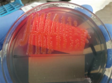 Colony morphology of E. coli Archives - Medical Notes