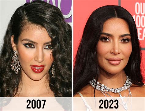 Fans Think Kim Kardashian Got Another Nose Job After Seeing Before And After Pics: ‘Her Surgeon ...